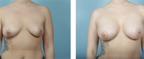 Patient 8
